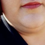 How To Get Rid of Double Chin and Face Fat Fast – News4Masses how to get rid of double chin and facial flab fast