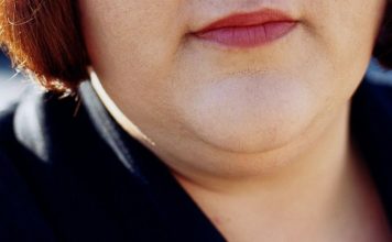 How To Get Rid of Double Chin and Face Fat Fast – News4Masses how to get rid of double chin and facial flab fast