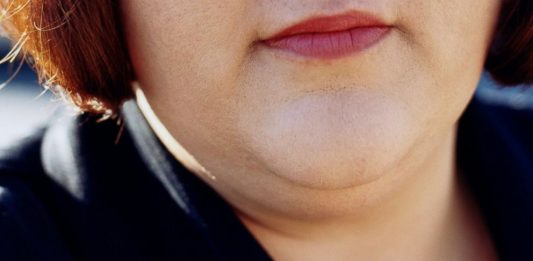 How To Get Rid of Double Chin and Face Fat Fast – News4Masses how to get rid of double chin and facial flab fast