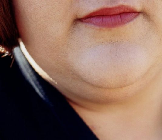 How To Get Rid of Double Chin and Face Fat Fast – News4Masses how to get rid of double chin and facial flab fast