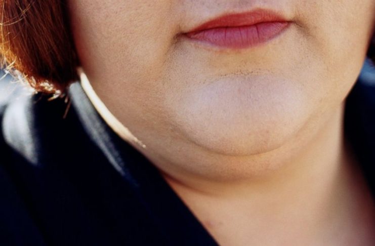 how to get rid of double chin and facial flab fast