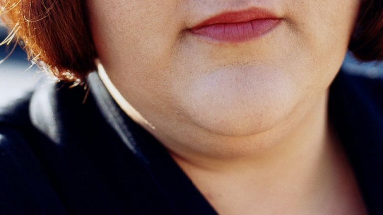 how to get rid of double chin and facial flab fast
