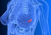 Indian American Researcher Amongst Scientists Identifying Potential Breast Cancer Drug breast cancer drug