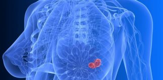 Indian American Researcher Amongst Scientists Identifying Potential Breast Cancer Drug breast cancer drug