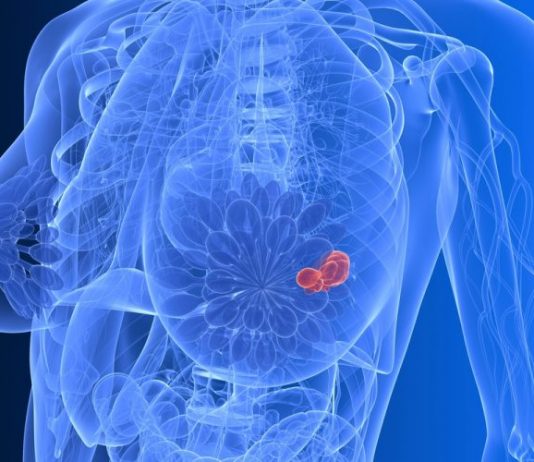 Indian American Researcher Amongst Scientists Identifying Potential Breast Cancer Drug breast cancer drug