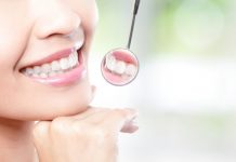 All You Wanted To know About Dental Filling – Procedure, Type & Cost Dental Fillings