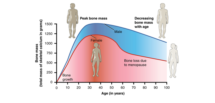 Prevent Osteoporosis - Healthy Bones