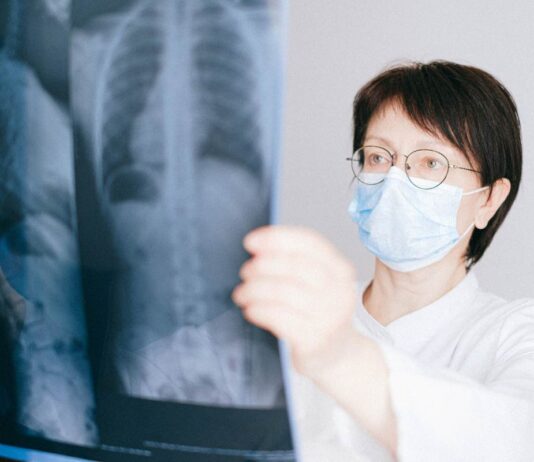 Is Lung Cancer Restricted To Smokers? Lung Cancer Awareness Month Lung Cancer Awareness Month