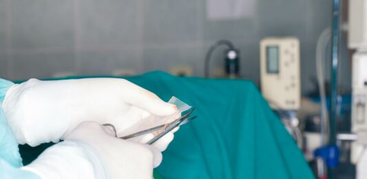 Have You Been Advised Hernia Surgery? Here’s A Comprehensive Review, You Must Know Hernia Surgery in progress