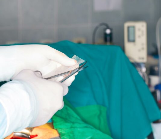 Have You Been Advised Hernia Surgery? Here’s A Comprehensive Review, You Must Know Hernia Surgery in progress