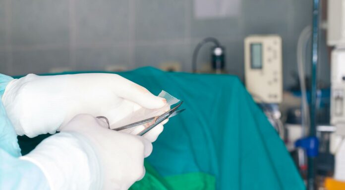 Have You Been Advised Hernia Surgery? Here’s A Comprehensive Review, You Must Know Hernia Surgery in progress