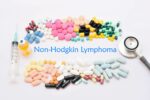 What You Need To Know About Non-Hodgkin’s Lymphoma Non-Hodgkin-Lymphoma