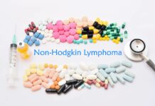 What You Need To Know About Non-Hodgkin’s Lymphoma Non-Hodgkin-Lymphoma