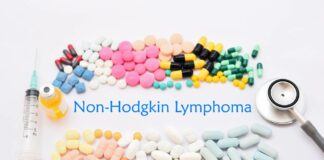 What You Need To Know About Non-Hodgkin’s Lymphoma Non-Hodgkin-Lymphoma