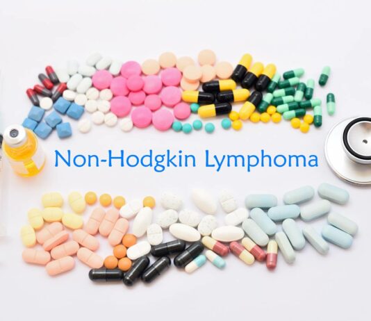 What You Need To Know About Non-Hodgkin’s Lymphoma Non-Hodgkin-Lymphoma